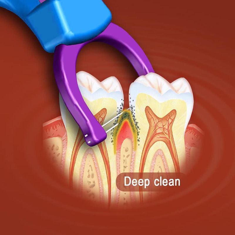 Hilo dental T.Smile 1 mango + 100 recargas