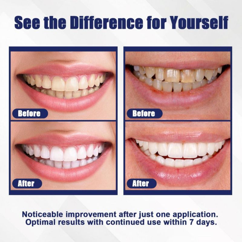 Blanqueador Dental KAKUJ – 14 Tratamientos (28 Tiras)