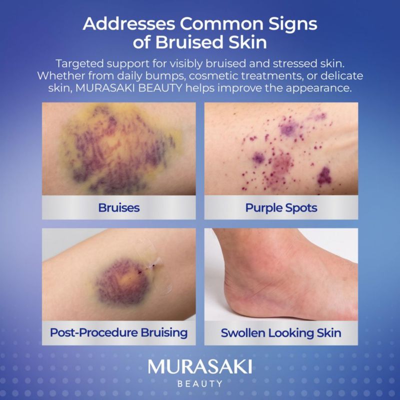 Suero facial MURASAKI BEAUTY 30 ml Arnica y vitaminas K & E