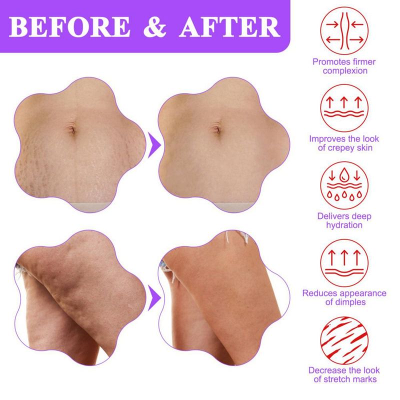 Crema reafirmante para abdomen MYNASEVO 100 ml – Tensado y firmeza de la piel
