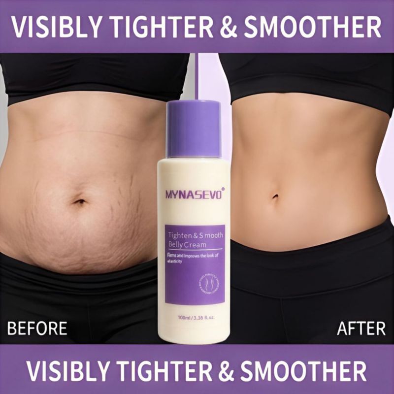 Crema reafirmante para abdomen MYNASEVO 100 ml – Tensado y firmeza de la piel