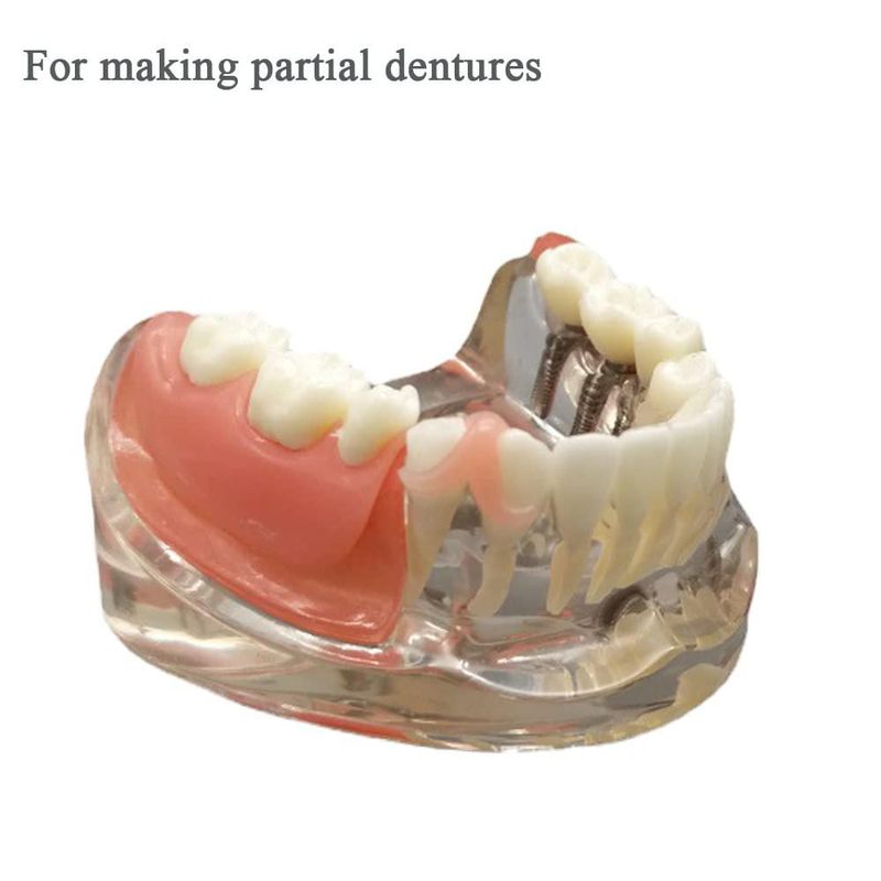 Kit DIY de material para encías de prótesis dental 30 g