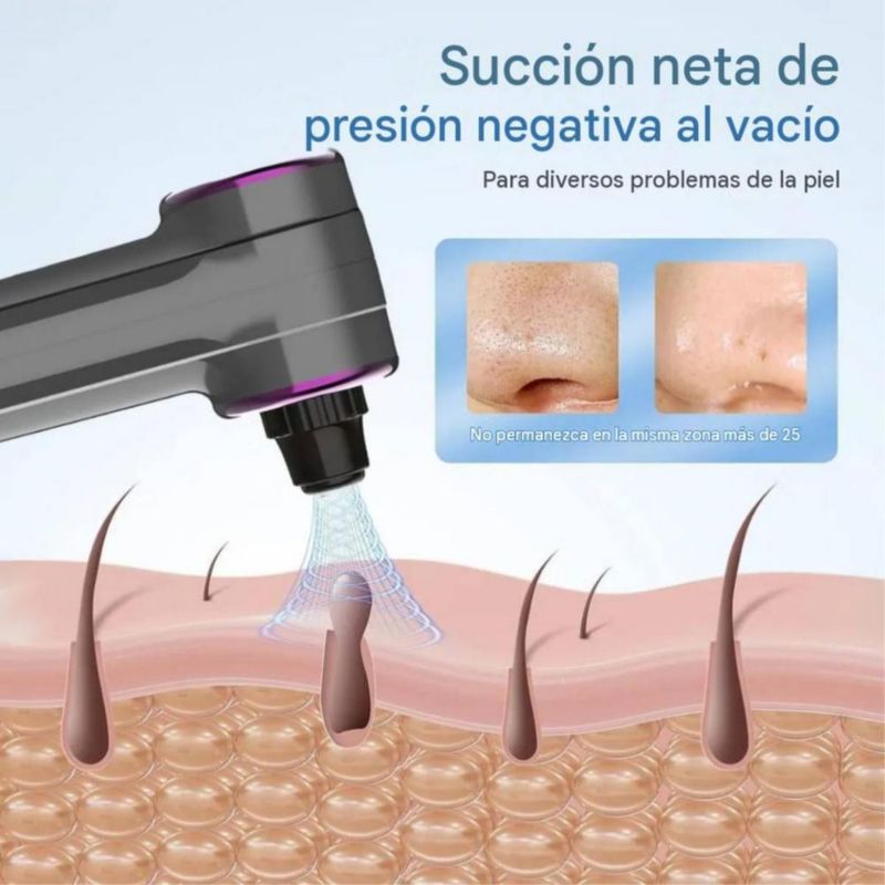 Removedor De Espinillas Kit De Limpieza Facial, Limpiador De Poros Con 3 Niveles Gris
