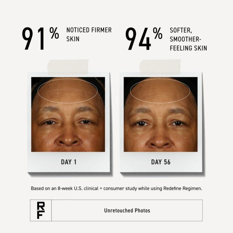 Loción Redefine Nocturna RODAN + FIELDS
