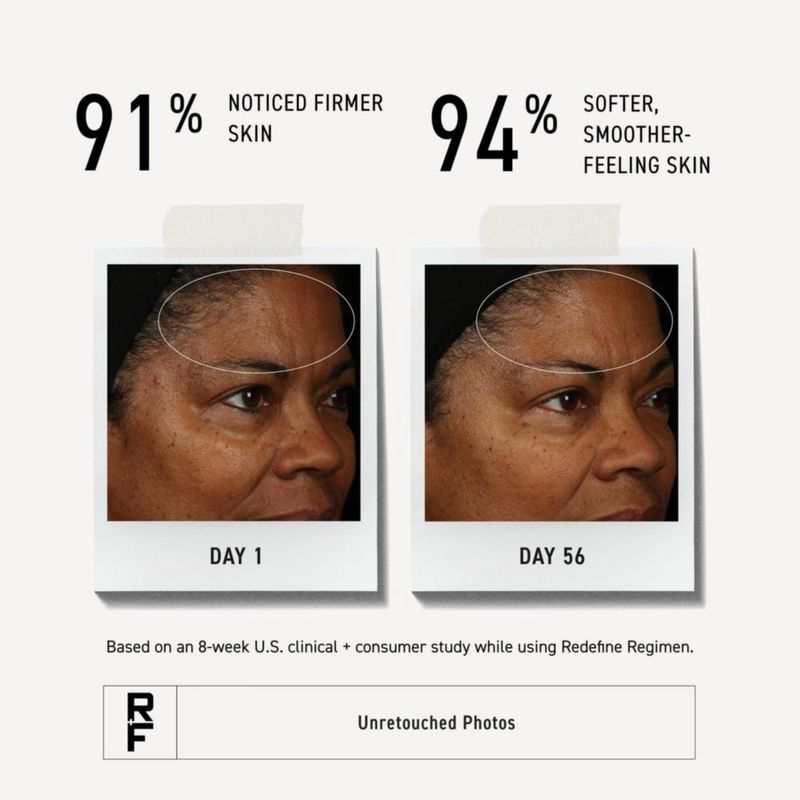 Loción Redefine Nocturna RODAN + FIELDS