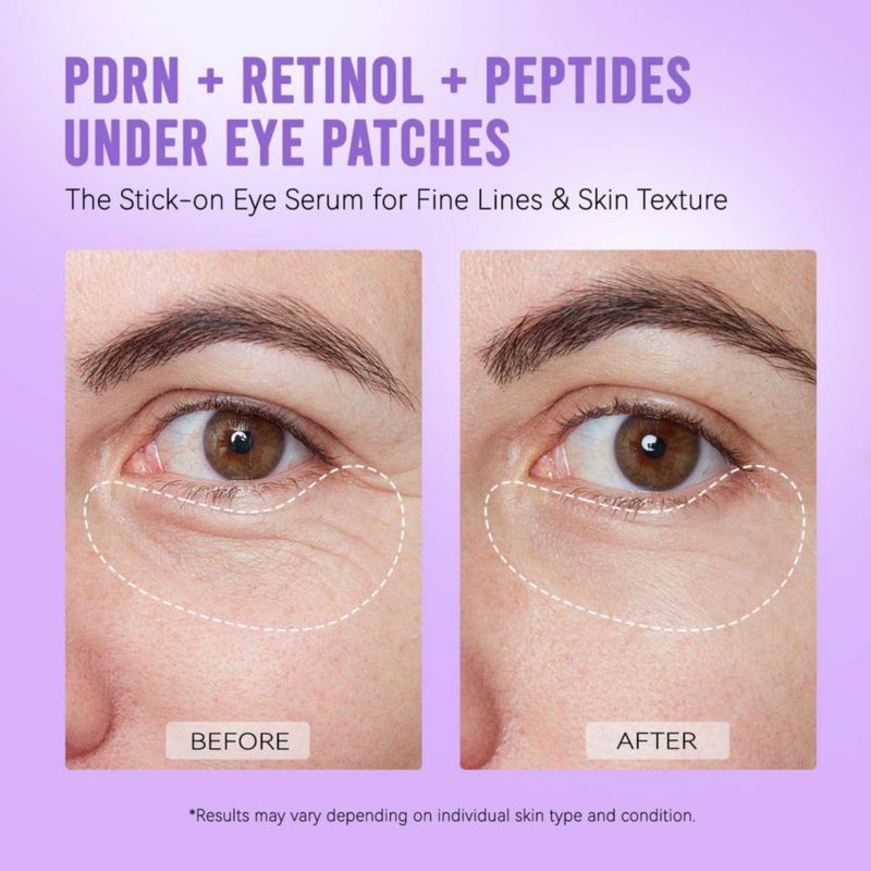 Parche ocular AILEORY PDRN Retinol - 48 pares