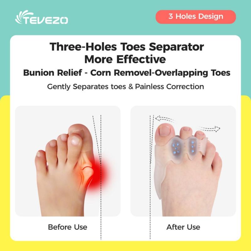 Separadores de dedos Tevezo Corrector de juanetes – Talla grande para adultos