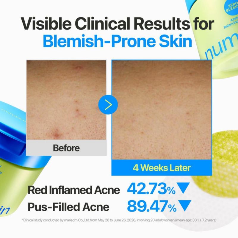 Almohadillas tonificantes numbuzin Zero Blemish con Ácido Azelaico y Centella