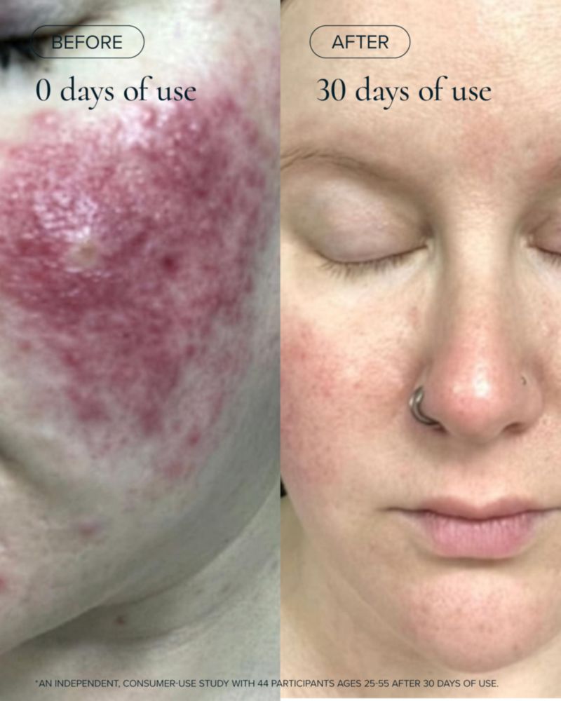 Aceite facial MARA 15 ml Tratamiento de algas y retinol