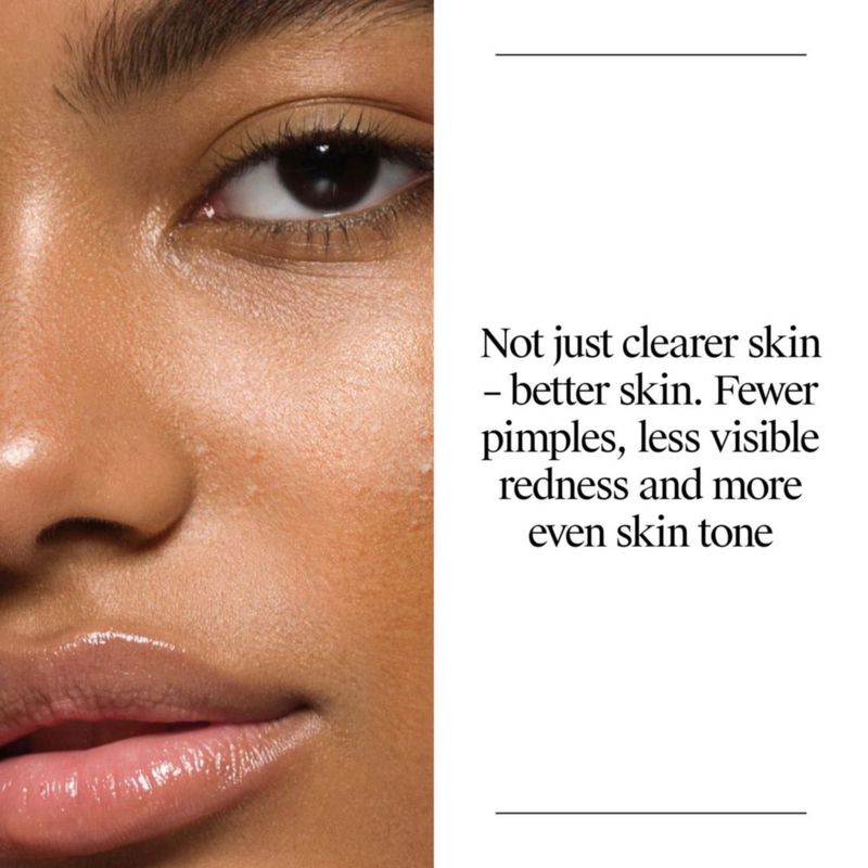 Limpiador Facial Neutrogena 473 ml Sin Aceite y Ácido Salicílico para Acné