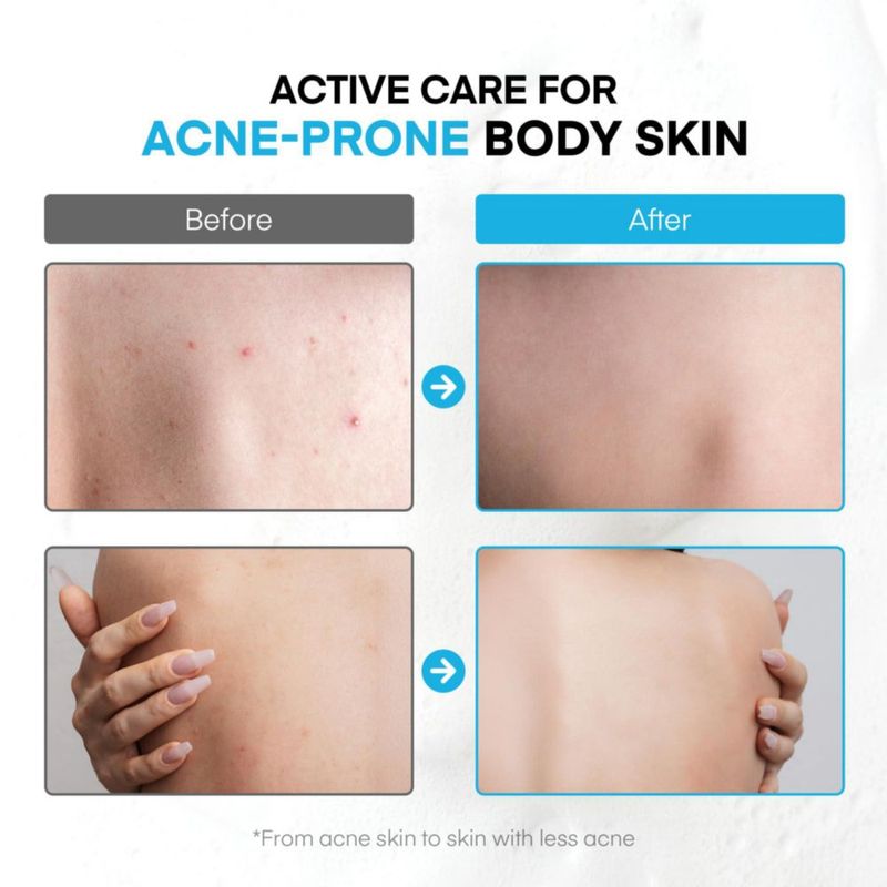 Gel de baño ProBliva 500 ml antibacteriano y antiacné
