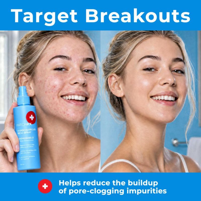 Spray facial PatchRx 240 ml paquete de 2 para piel sensible
