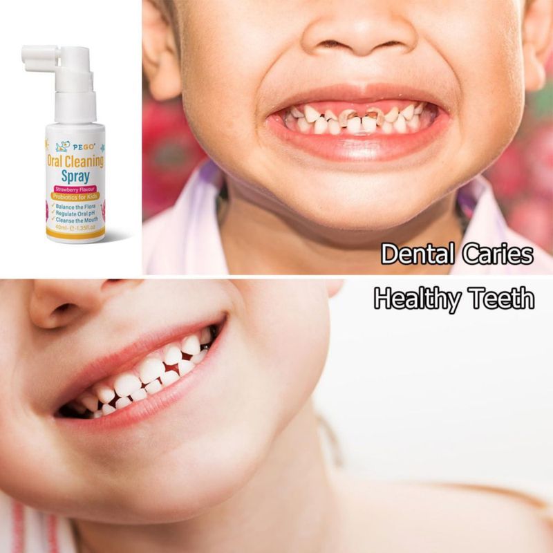 Spray bucal AOAO 40 ml para niños sin flúor sabor fresa