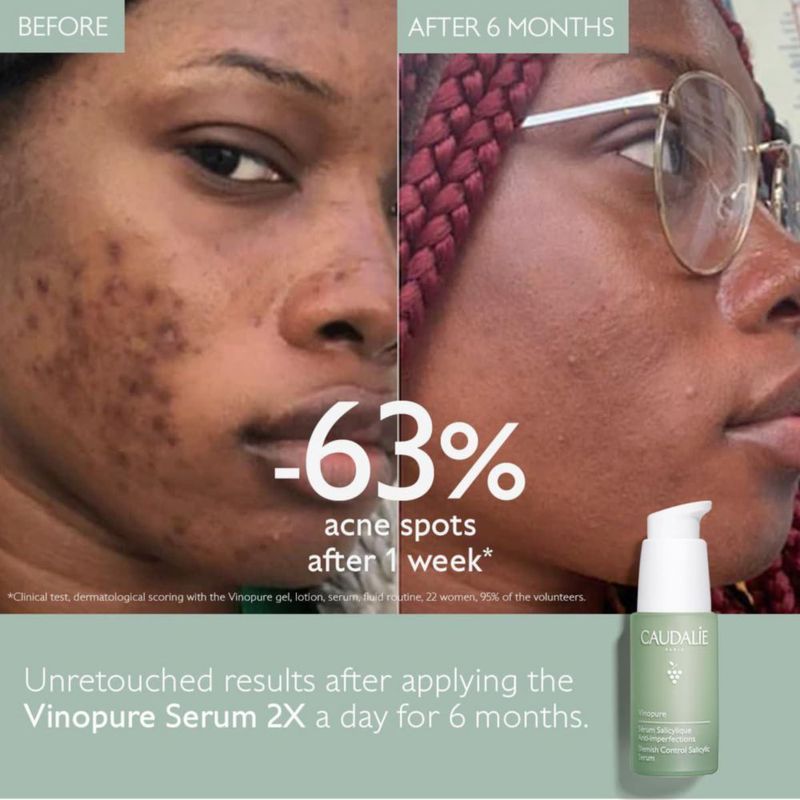 Sérum Caudalie Vinopure de ácido salicílico natural para minimizar los poros