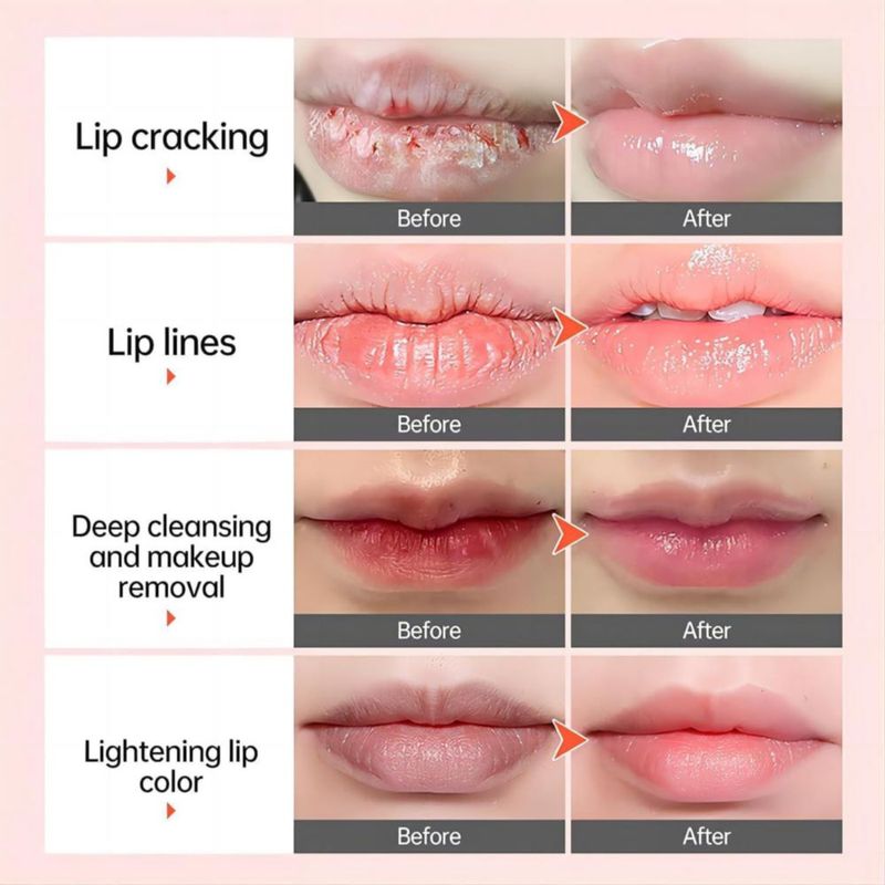 Bálsamo Labial Genérico para Labios Oscuros – Exfoliante e Hidratante