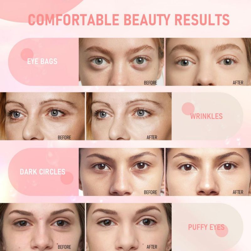 Mascarilla para ojos LAVONE 30 pares de parches de colágeno de rosa