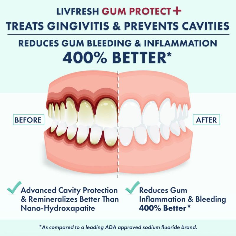 Pasta dental LIVFRESH Protección de encías 50 g sabor Wintergreen