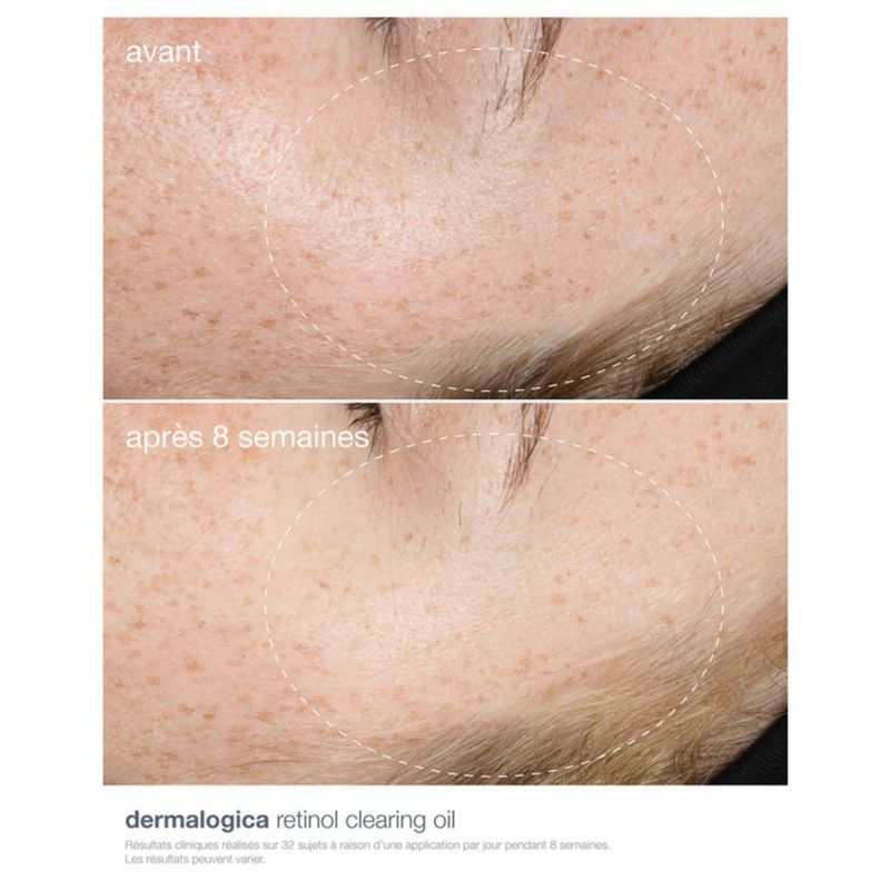 Aceite Dermalogica Retinol Clearing con Lípidos Fitoactivos 30 mL