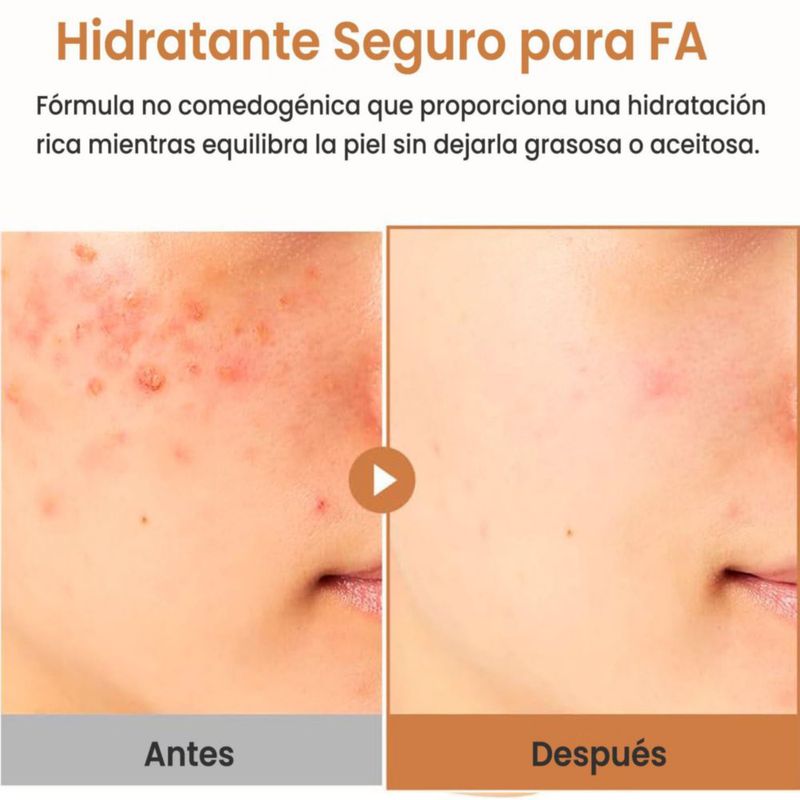Purito Oat In Calming Gel Cream 100ml Crema Hidratante Facial Piel