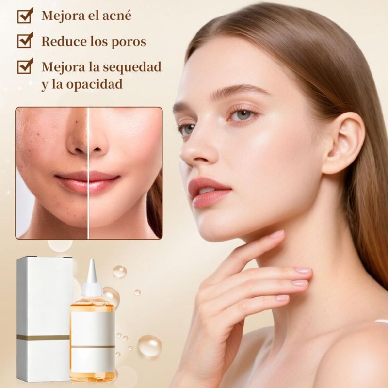 Ácido Glicólico 7 Solución FSHNSH Piel Grasa 1ml