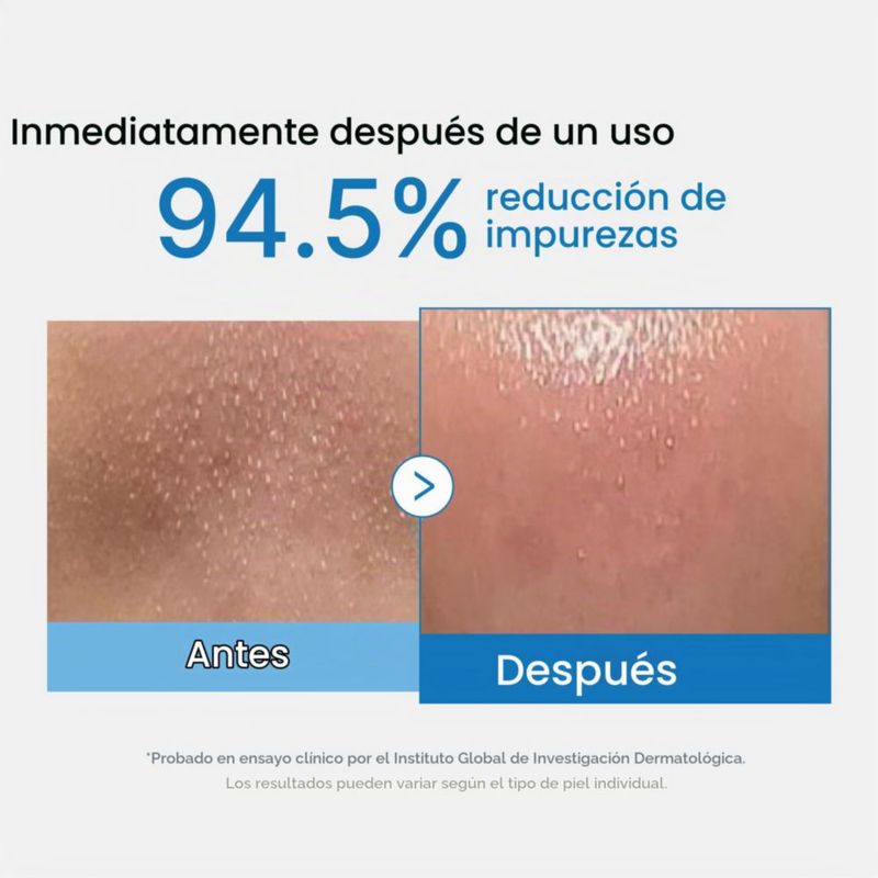 Aceite Limpiador MEDICUBE Zero Pore Blackhead 205 ml