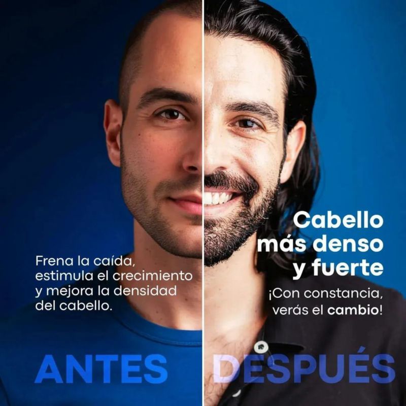 Anacastel Minoxidil 5 Spray Anticaída 6 Pack