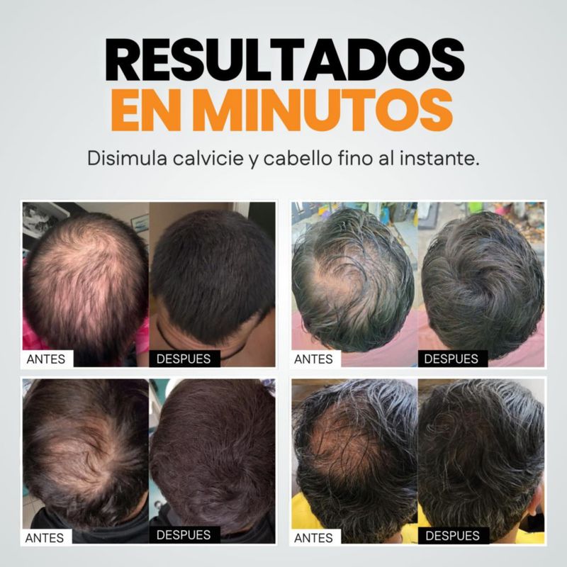 Fibras Capilares Henrys Negro 27 5g Aumenta Volumen y Densidad