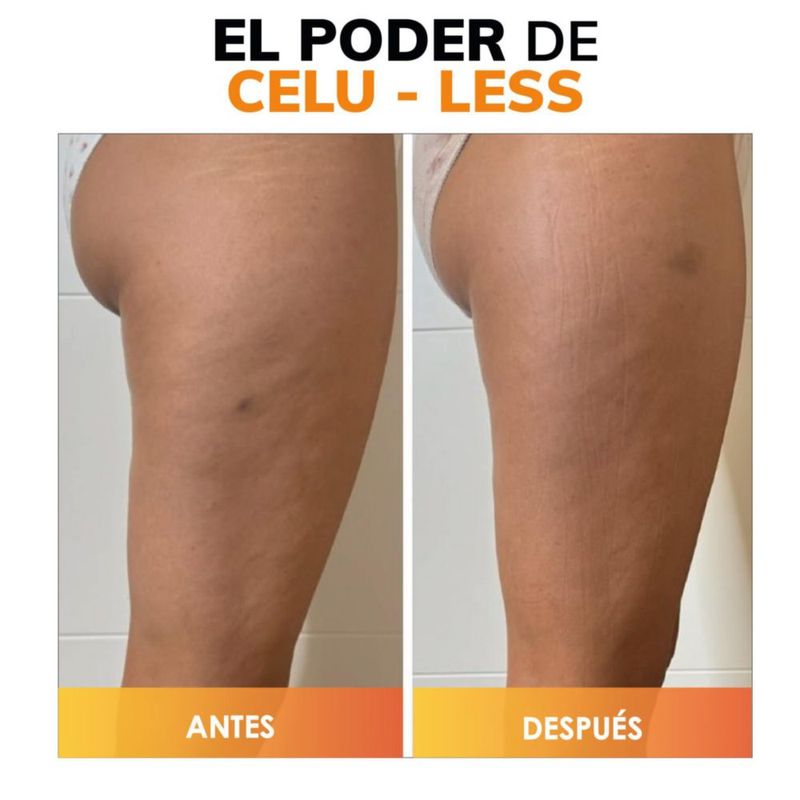 Celu Less Kilani Crema Celulitis Super Concentrada Cafeína Pura