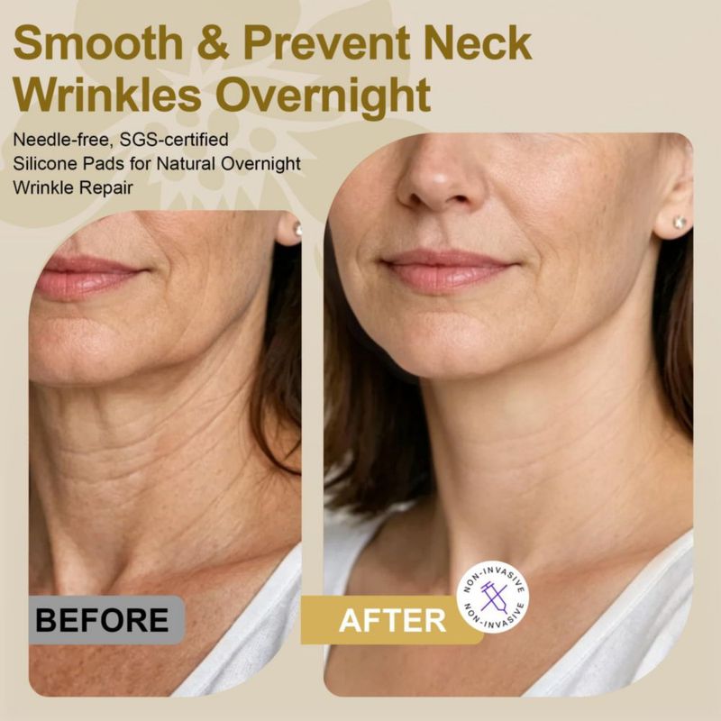 Paquete de 4 parches para el cuello Luxe Sens – Suministro de 40 días