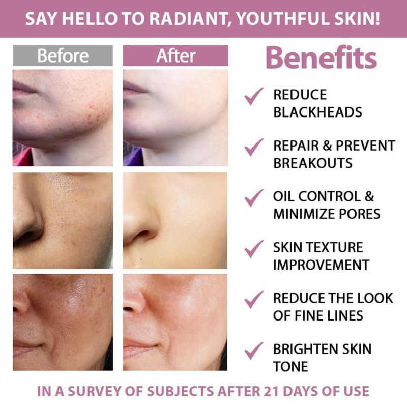 Las almohadillas exfoliantes me cuidan con ácido glicólico al 20% y ácido salicílico al 2%