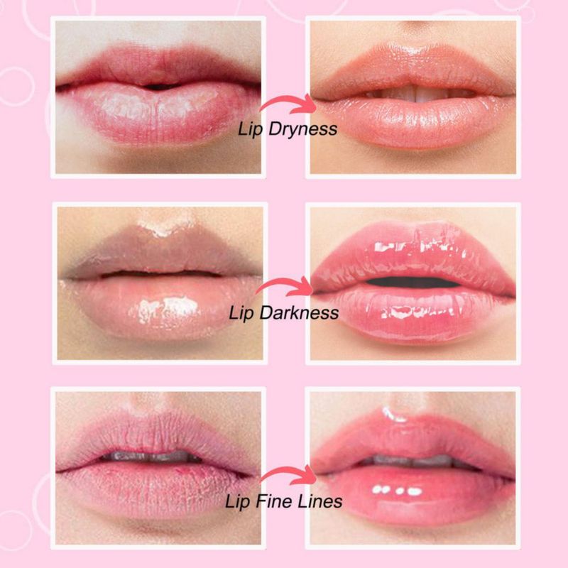 Mascarilla Labial NIYET 30 uds Colágeno Cristal Rosa