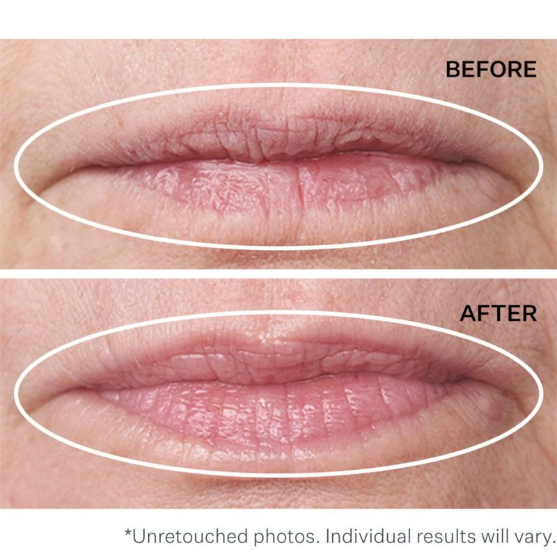Tratamiento StriVectin Antiarrugas Double Fix para labios