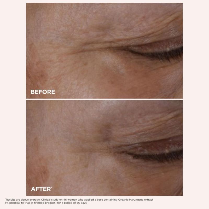 Crema para ojos CLARINS Total Eye Lift – Kit anti‑edad