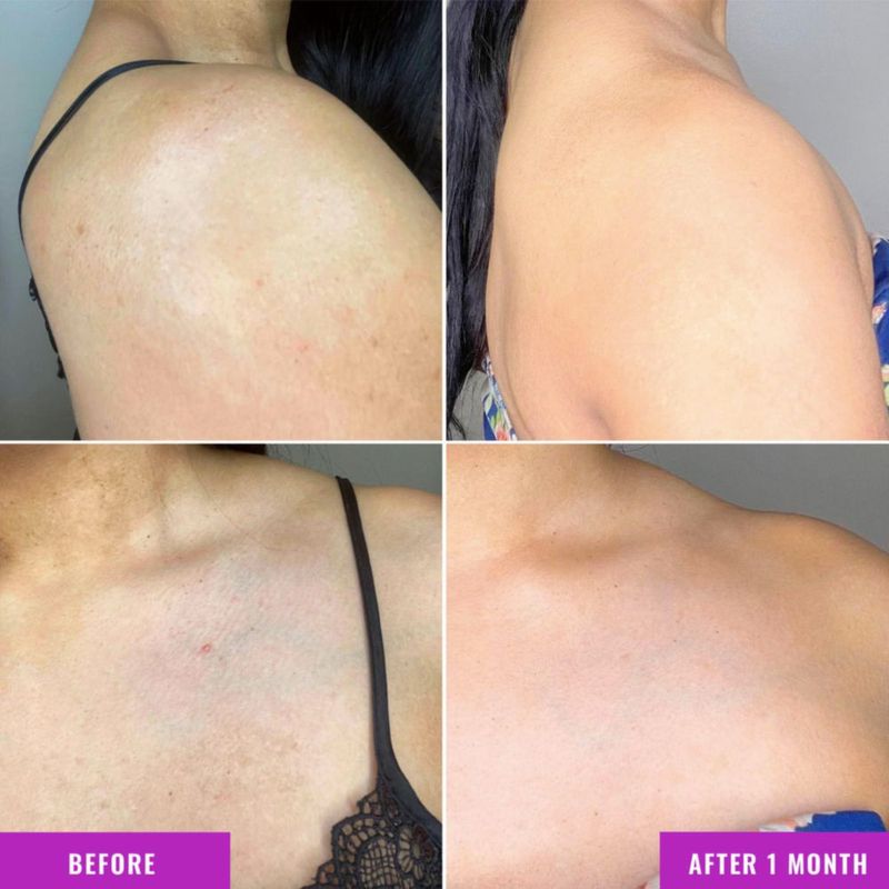 Crema de tratamiento corporal Good Molecules para corregir la decoloración