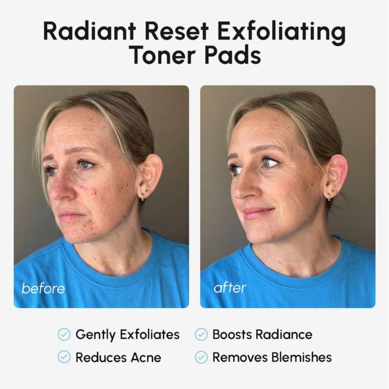 Toallitas Limpiadoras Faciales MAREE con Ácido Glicólico y Almohadillas Exfoliantes