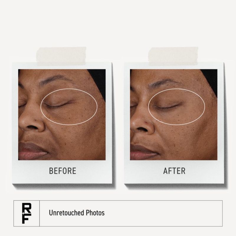 Suero Facial RODAN + FIELDS Pure C con 10% de Vitamina C
