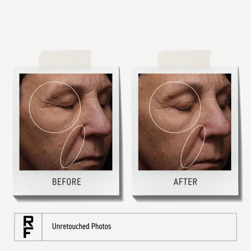 Suero Facial RODAN + FIELDS Pure C con 10% de Vitamina C