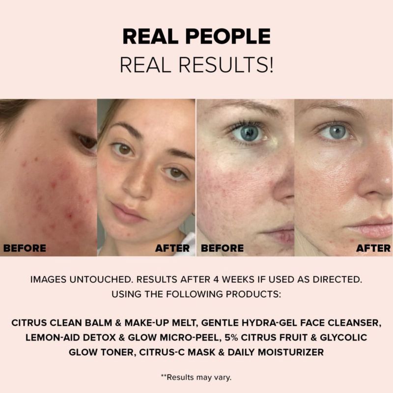 Exfoliante Facial Nudestix 60 ml Lemon‑Aid Micro‑Peel