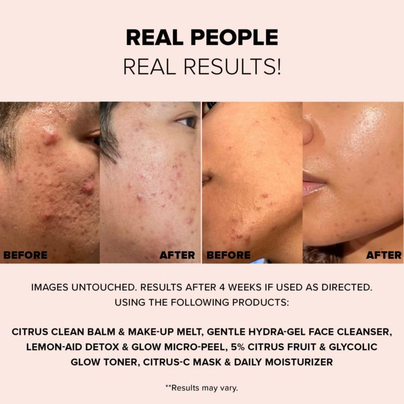 Exfoliante Facial Nudestix 60 ml Lemon‑Aid Micro‑Peel