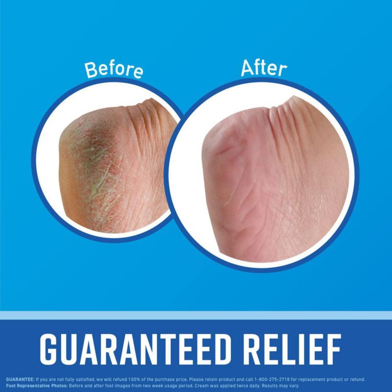 Crema para manos y pies O'Keeffe's Working Hands and Healthy Feet