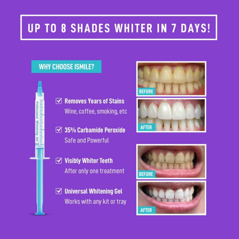 Paquete de recarga de jeringas de gel blanqueador de dientes iSmile 3 x 3 ml