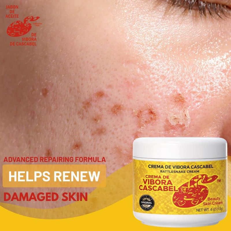 Crema de Belleza JABÓN DE ACEITE VÍBORA DE CASCABEL 113 ml