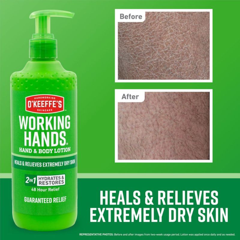 Loción O'Keeffe's Working Hands para manos y cuerpo 355 ml (paquete de 1)