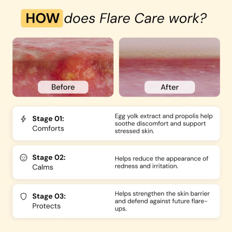 Juego de bálsamos MyMagicHealer Comfort Flare Care 28 ml