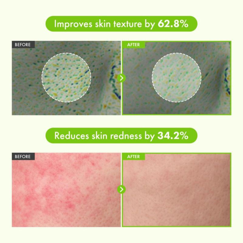TOSOWOONG Suero de Té Verde 60% Panthenol para Calmar Apoyo a la Barrera Cutánea e Hidratación de Piel Seca Sensible e Irritada con Dexpantenol 5% y