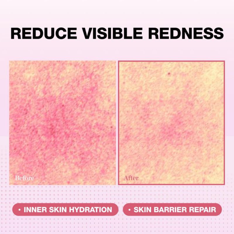 Physiogel Esencia Calmante Roja 200 ml – Hidratación y Reparación