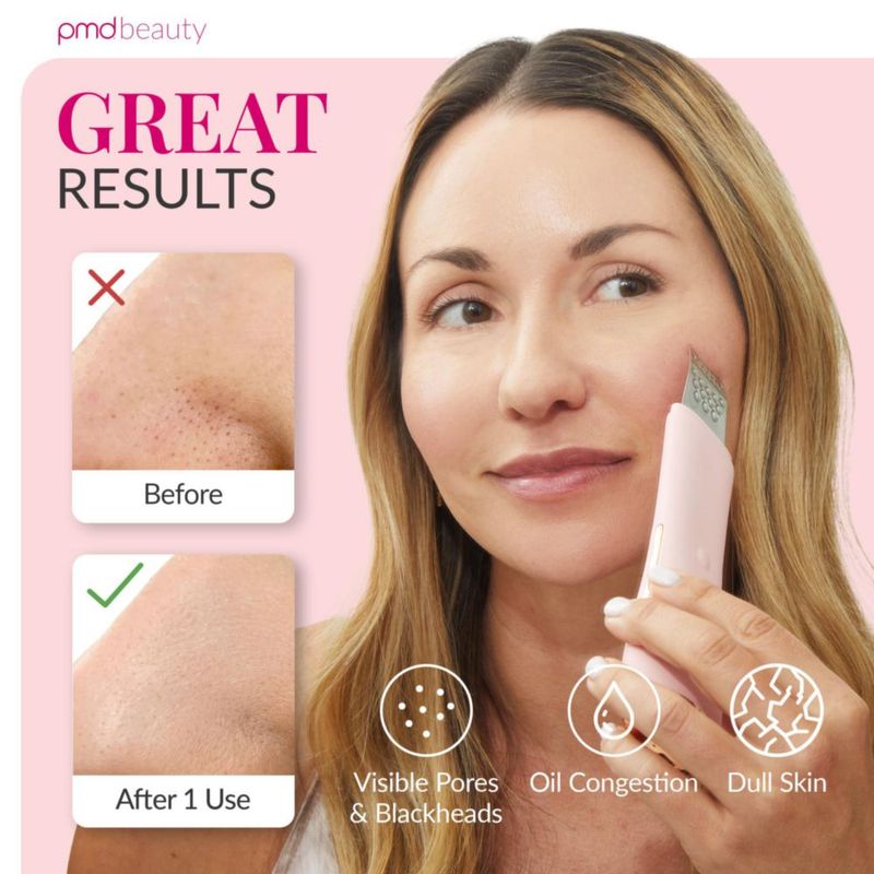 Espátula Facial PMD Beauty Wave Pro Eliminador de Puntos Negros
