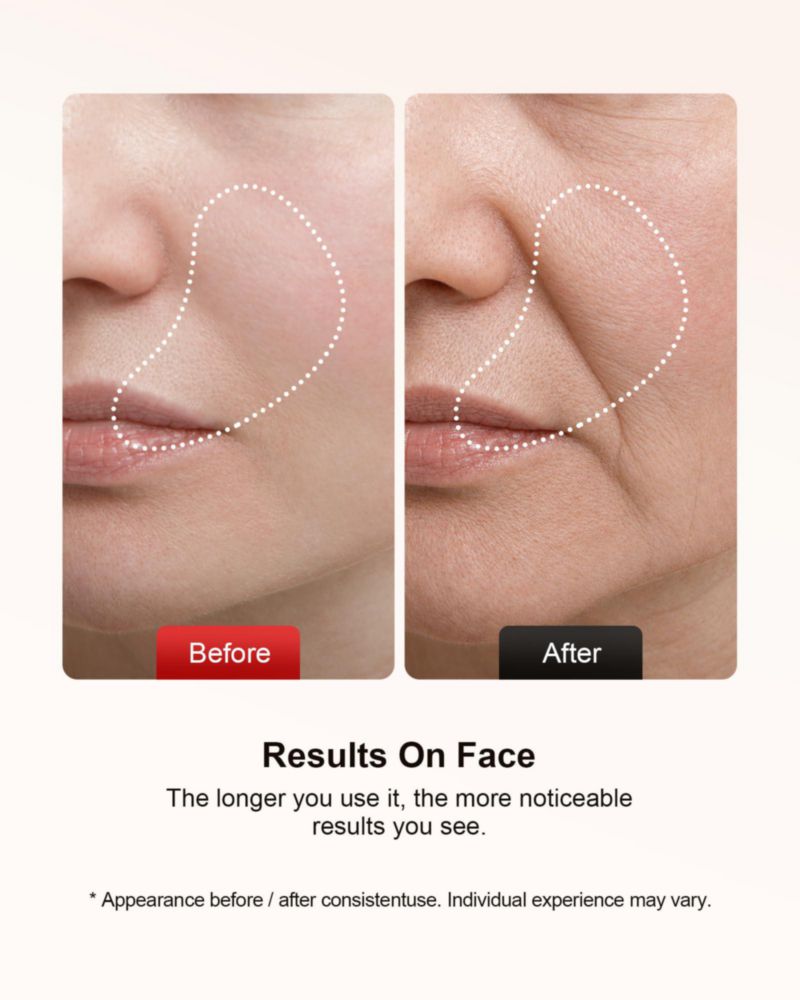 Masajeador facial Pedete de 7 colores con terapia de luz roja